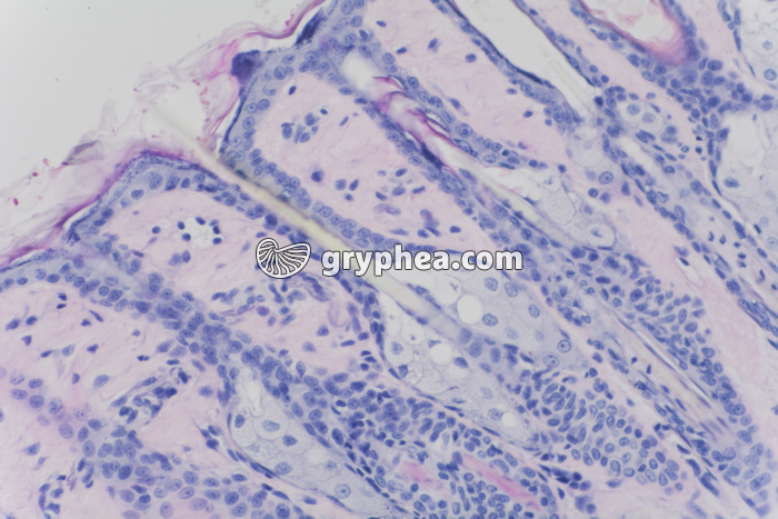 Peau avec glandes sébacées x100 - gryphea.org